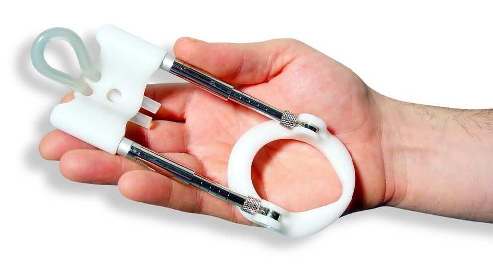 Erweitern Sie, um die Größe eines Mitglieds zu erhöhen